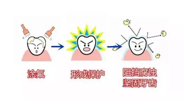 牙齿涂氟是在牙齿的表面涂上一层薄薄的氟化物,这层氟化物相当于是